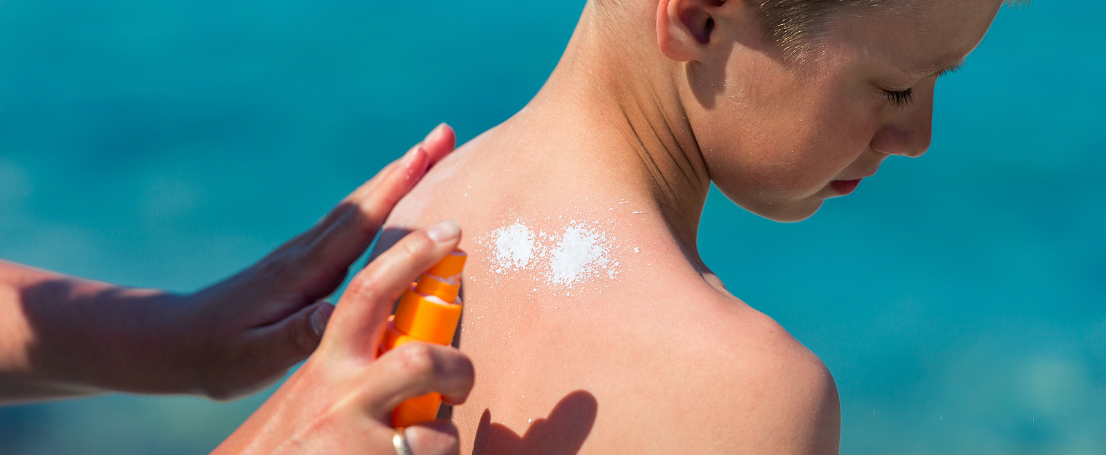 Zonverbranding bij kinderen voorkomen